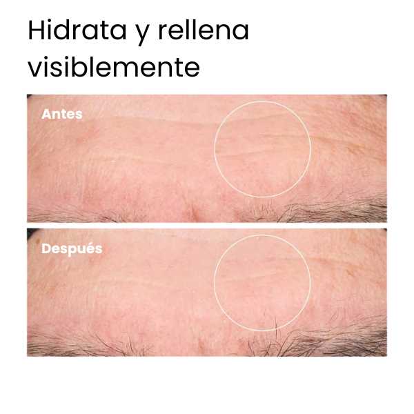ACIDO HIALURONICO THE ORDINARY 2% + B5: Hidrata y rejuvenece tu piel al instante